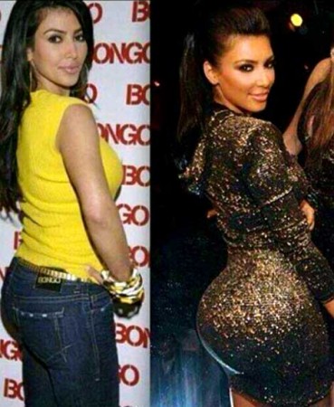 Kim-Kardashian-buttox-augmentation-Surgery-Before-and-After-Photos